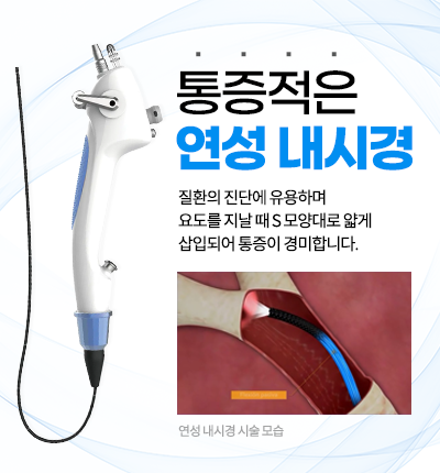 연성내시경